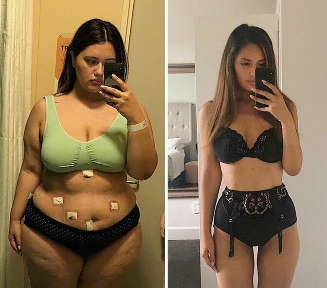 The girl before and after losing weight with KETO Complete . capsules